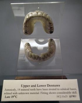 Dentures, upper & lower